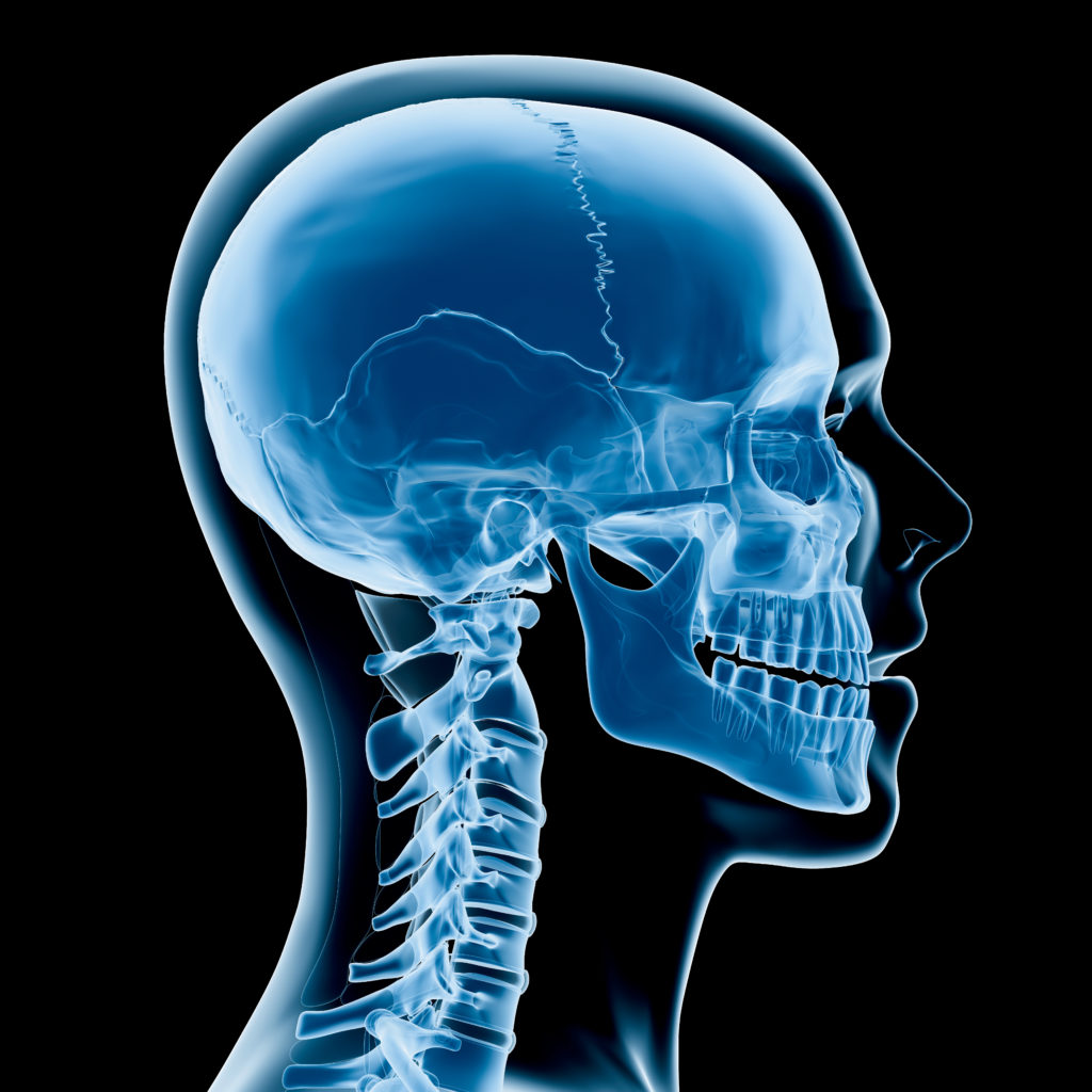 x-ray of a skull